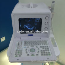 ultrasound machines home use & diagnostic system price (DW330)
Welcome your enquiry for full digital ultrasound!